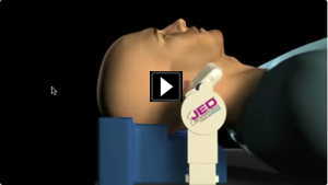JED - Jaw Elevation Device - Image 1